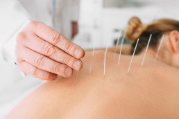 La acupuntura en la fertilidad